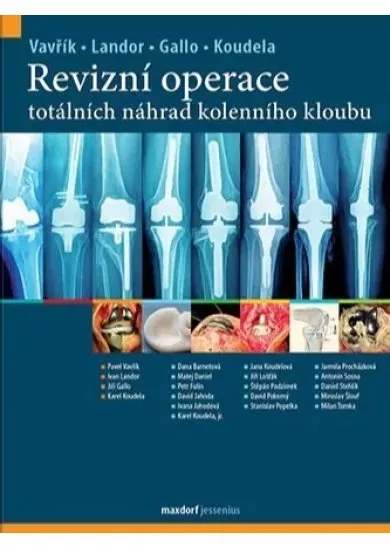 Revizní operace totálních náhrad kolenního kloubu