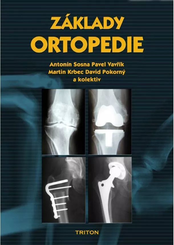 Antonín Sosna  - Základy ortopedie