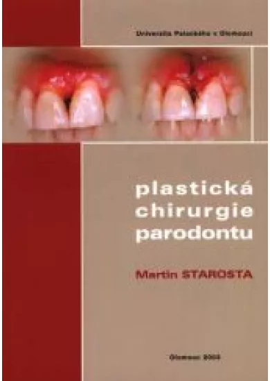 Plastická chirurgie parodontu