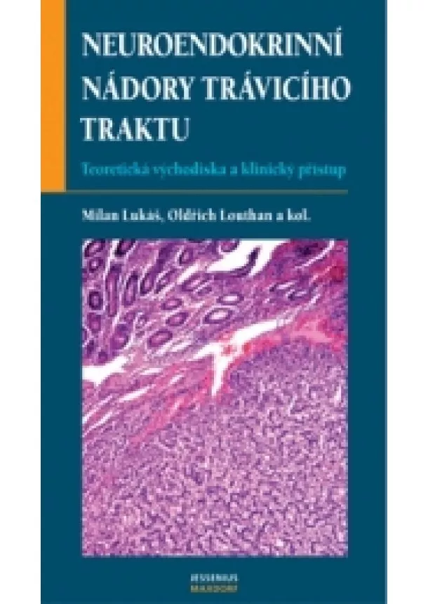 Milan Lukáš, Oldřich Louthan a kol. - Neuroendokrinní nádory trávicího traktu - Teoretická východiska a klinický přístup