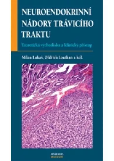 Neuroendokrinní nádory trávicího traktu - Teoretická východiska a klinický přístup