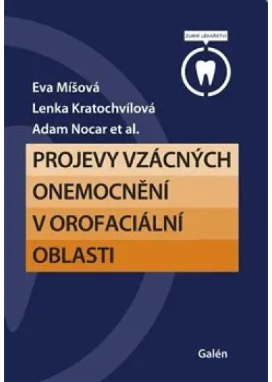 Projevy vzácných onemocnění v orofaciální oblasti