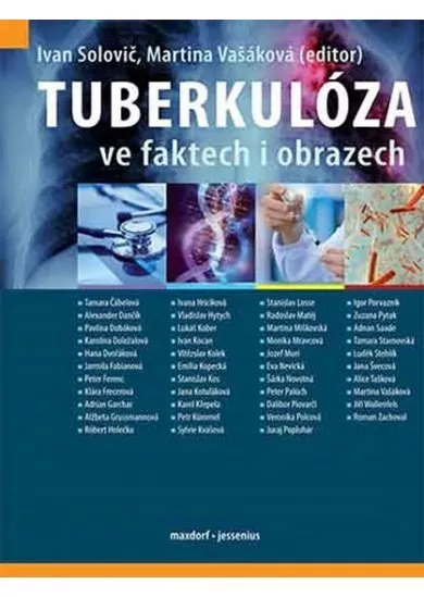 Tuberkulóza ve faktech i obrazech