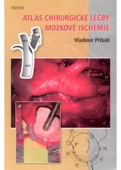 Atlas chirurgické léčby mozkové ischemie