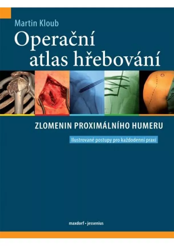 Martin Kloub - Operační atlas hřebování zlomenin proximálního humeru