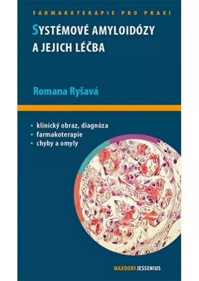 Systémové amyloidózy a jejich léčba