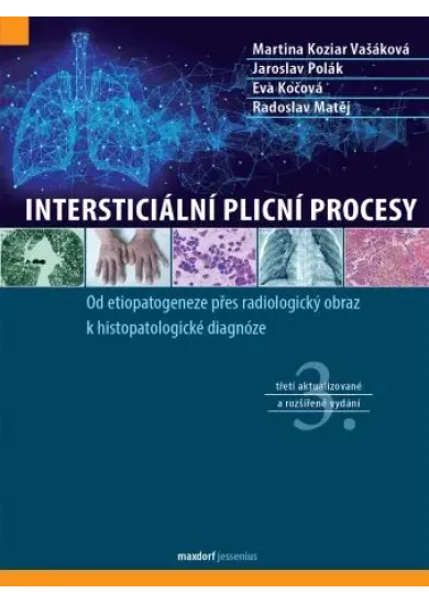 Intersticiální plicní procesy