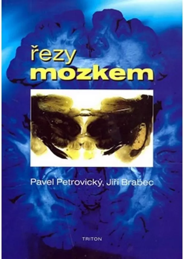 Pavel Petrovický, Jiří Brabec - Řezy mozkem - Anatomické, , mikroskopické a magnetické