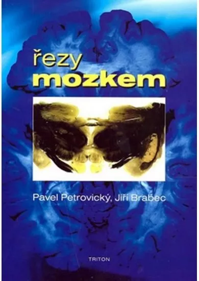 Řezy mozkem - Anatomické, , mikroskopické a magnetické