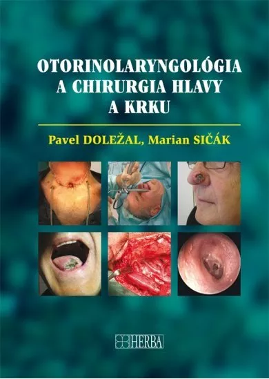 Otorinolaryngológia a chirurgia hlavy a krku