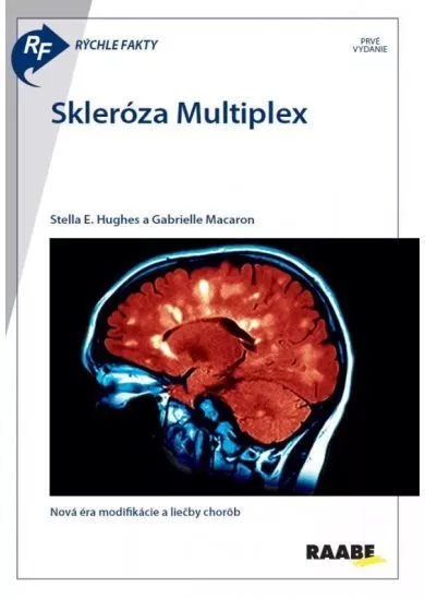 Rýchle fakty : Skleróza multiplex