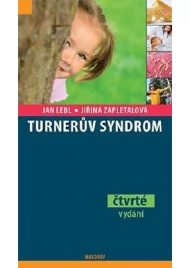 Jan Lebl, Jiřina Zapletalová  - Turnerův syndrom - 3. vydání