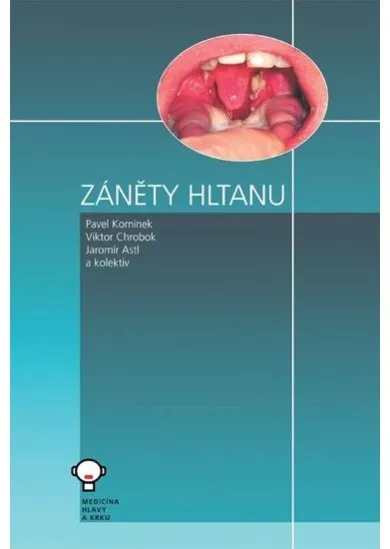 Záněty hltanu - 3. upravené vydání