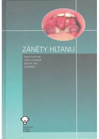 Záněty hltanu