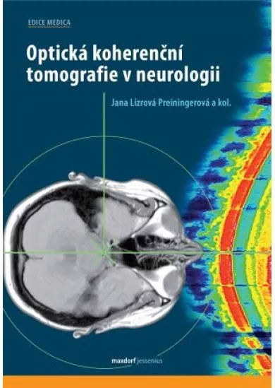 Optická koherenční tomografie v neurologii