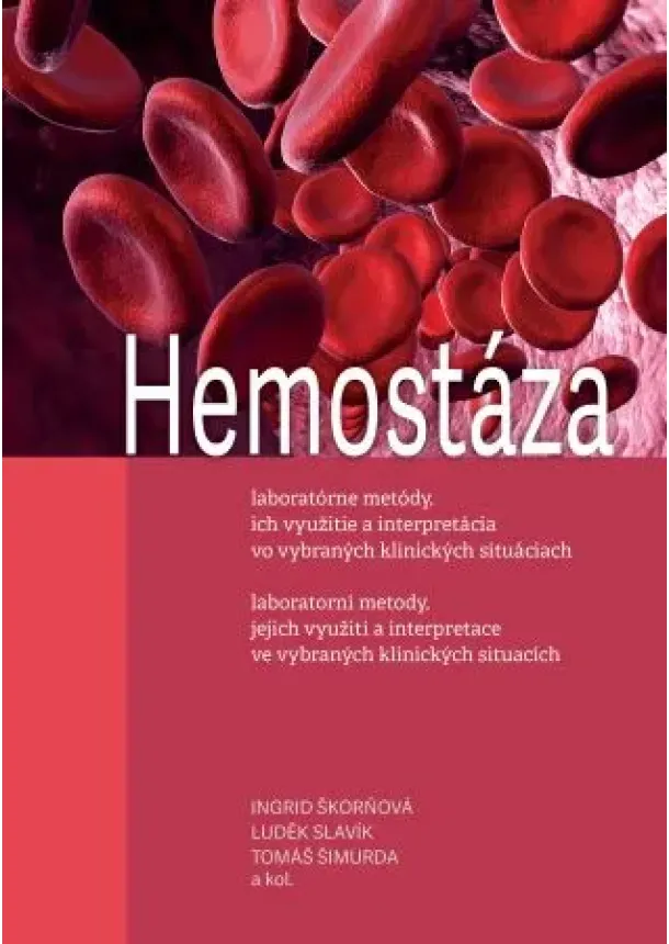 Ingrid Škorňová, Luděk Slavík, Tomáš Šimurda - Hemostáza, laboratorní metody, jejich využití a interpretace ve vybraných klinických situacích (3.vy