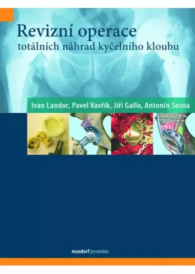 Revizní operace totálních náhrad kyčelního kloubu