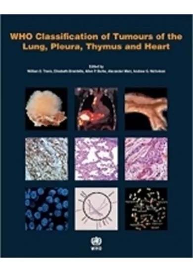 WHO classification of tumours of the lung, plura, thymus and heart
