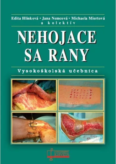 Nehojace sa rany - Vysokoškolská učebnica