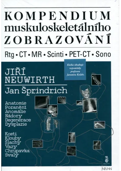 Kompendium muskuloskeletálního zobrazování
