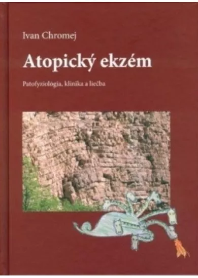 Atopický ekzém - Patofyziológia, klinika a liečba
