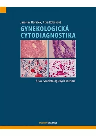 Gynekologická cytodiagnostika - Atlas cytohistologických korelací