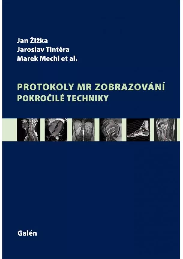 Jan Žižka, Jaroslav Tintěra, Marek Mechl  - Protokoly MR zobrazování. Pokročilé techniky
