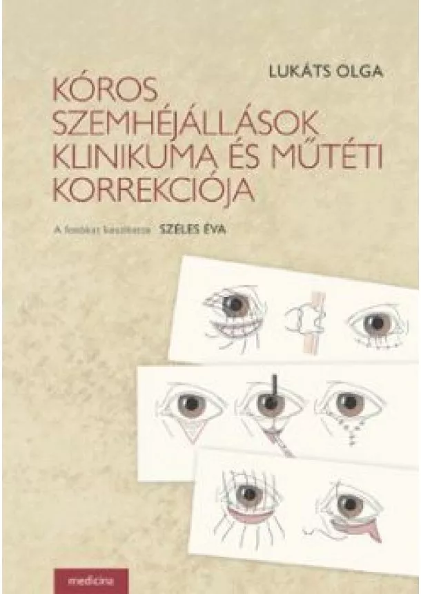 Lukáts Olga - KÓROS SZEMHÉJÁLLÁSOK KLINIKUMA ÉS MŰTÉTI KORREKCIÓJA