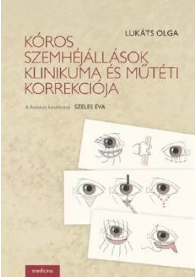 KÓROS SZEMHÉJÁLLÁSOK KLINIKUMA ÉS MŰTÉTI KORREKCIÓJA