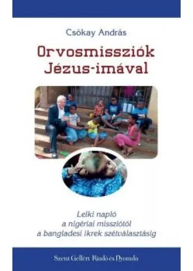 Orvosmissziók Jézus-imával - Lelki napló a nigériai missziótól a bangladesi ikrek szétválasztásáig
