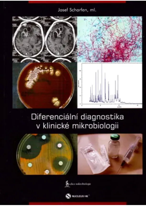 Josef Scharfen, ml. - Diferenciální diagnostika v klinické mikrobiologii