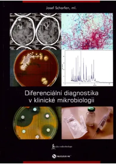Diferenciální diagnostika v klinické mikrobiologii