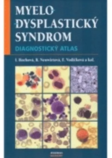 Myelodysplastický syndrom - Diagnostický atlas