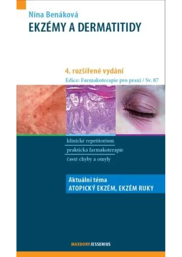 Nina Benáková - Ekzémy a dermatitidy (4. rozšířené vydání) - Aktuální téma: Chronický ekzém ruky, Atopický ekzém