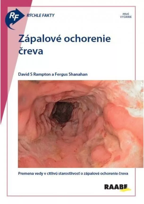 David S Rampton , Fergus Shanahan - Rýchle fakty: Zápalové ochorenie čreva