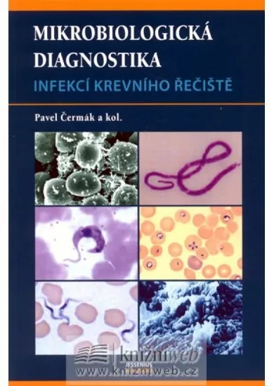 Mikrobiologická diagnostika - infekcí kr