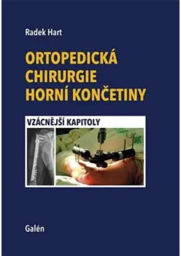 Radek Hart - Ortopedická chirurgie horní končetiny - Vzácnější kapitoly