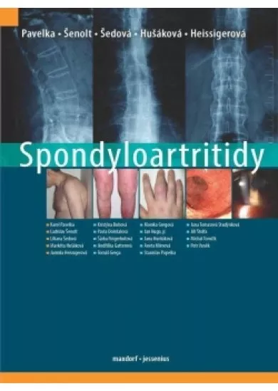 Spondyloartritidy