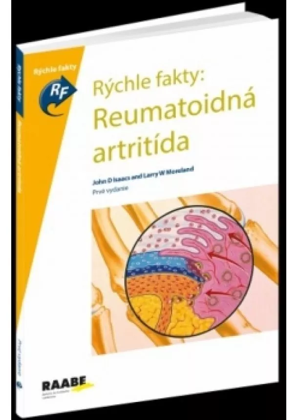 Kolektív autorov - Rýchle fakty: Reumatoidná ARTRITÍDA