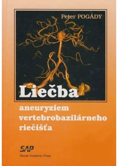 Liečba aneuryziem vertebrobazilárneho riečišťa