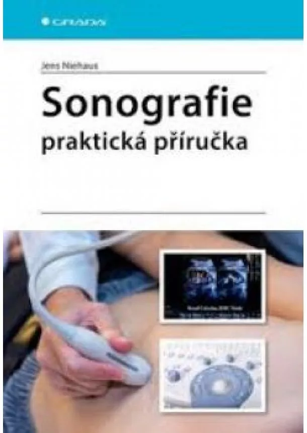 Jens Niehaus - Sonografie - praktická příručka