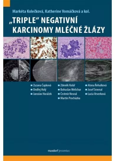 „Triple“ negativní karcinomy mléčné žláz