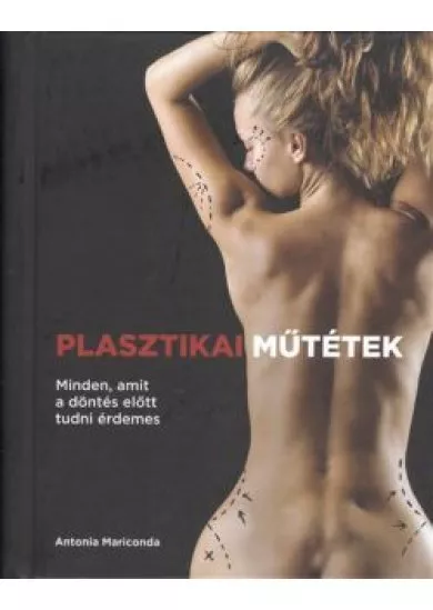 PLASZTIKAI MŰTÉTEK /MINDEN, AMIT A DÖNTÉS ELŐTT TUDNI ÉRDEMES