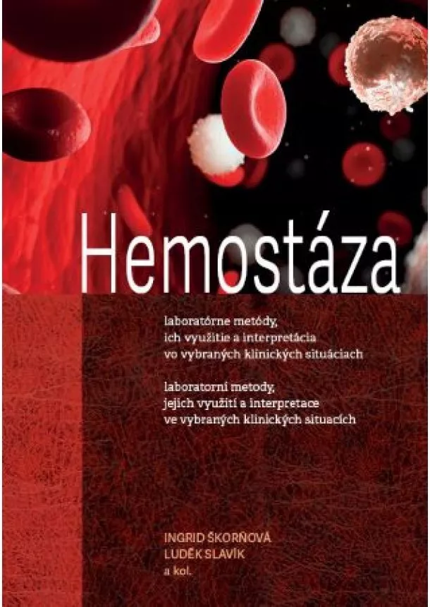 Ingrid Škorňová, Luděk Slavík - Hemostáza - laboratorní metody, jejich využití a interpretace ve vybraných klinických situacích
