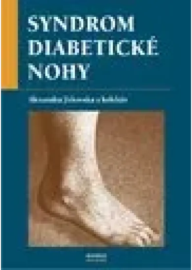 Syndrom diabetické nohy - Komplexní lékařská péče