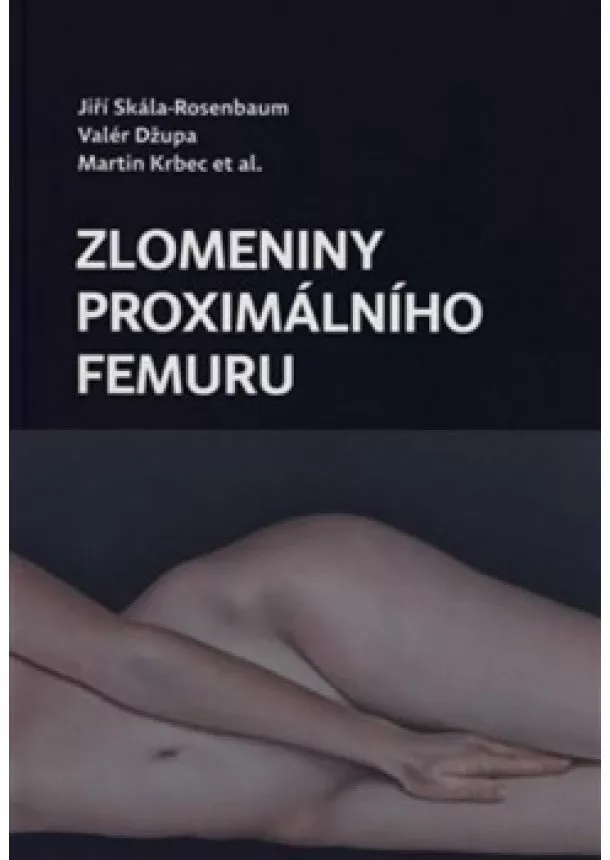 Martin Krbec, Jiří Skála-Rosenbaum, Valér Džupa - Zlomeniny proximálního femuru