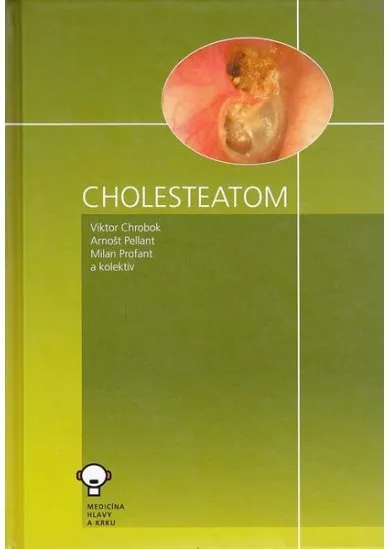 Cholesteatom