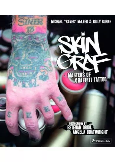 Skin Graf