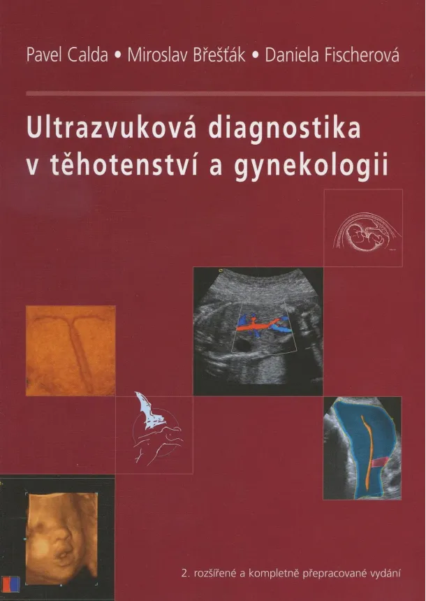 Pavel Calda, Miroslav Břešťák, Daniela Fischerová a kol. - Ultrazvuková diagnostika v těhotenství a gynekologii - 2. kompletní přepracované vydání