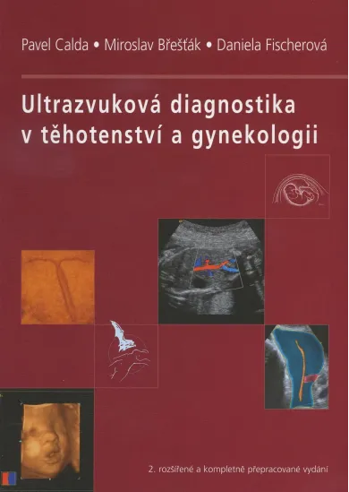Ultrazvuková diagnostika v těhotenství a gynekologii - 2. kompletní přepracované vydání